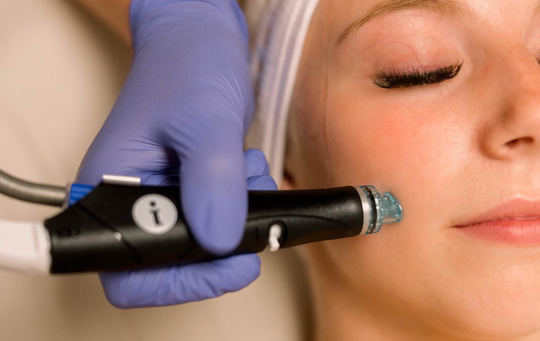 Summer HydraFacial Special